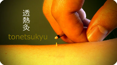 透熱灸 透熱灸