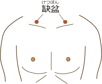 缺盆 缺盆