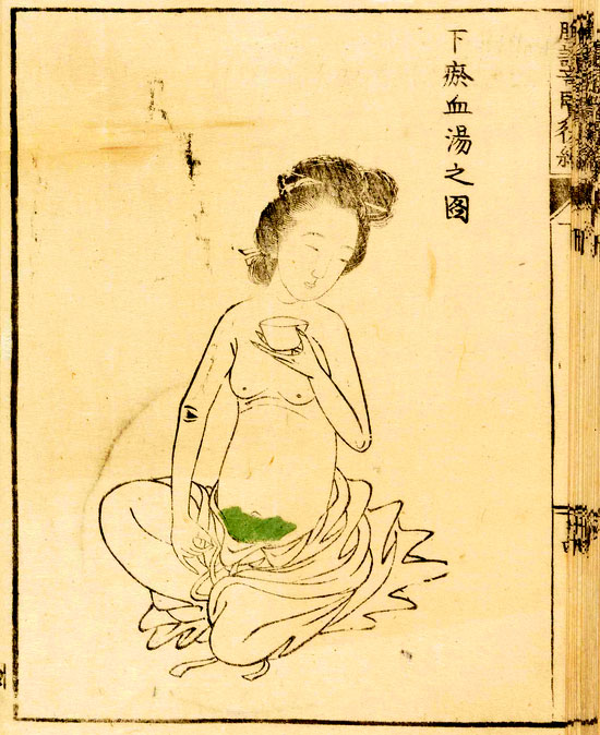 腹証奇覧