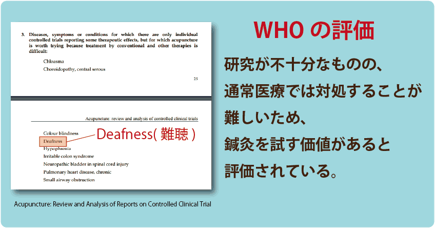 突発性難聴に対するWHOの見解