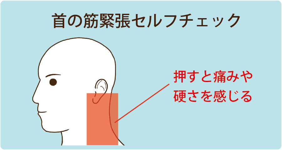 首と関係するめまいの場合に圧痛の出やすい場所