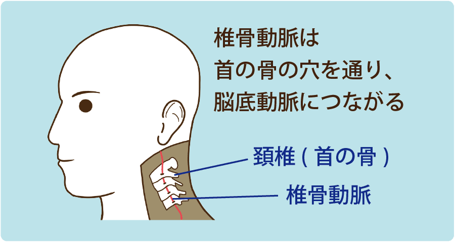 鍼灸によるめまいの施術について | 東京都練馬区の鍼灸院 - 成鍼堂